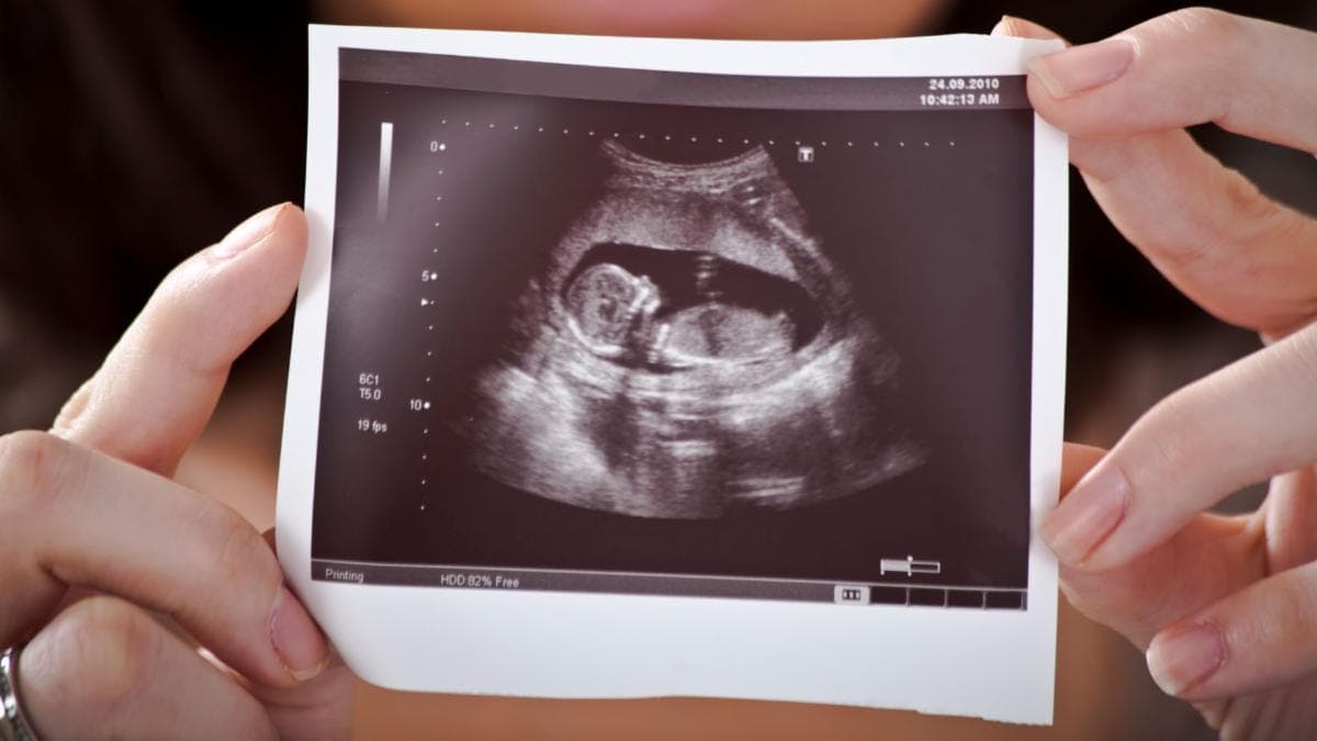 Worldwide Leading Cause of Death in 2019: Abortion